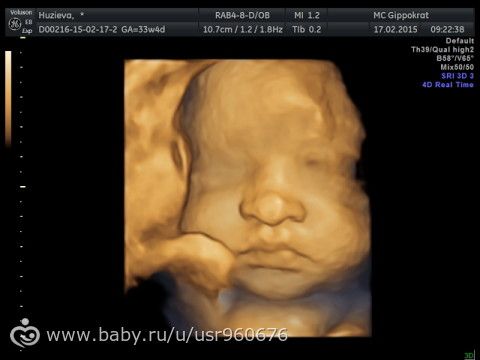 Узи с 34 недели беременности