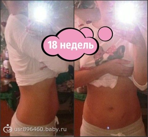 Беременные могут втягивать живот в себя 8 Беременные могут втягивать живот в себя 804