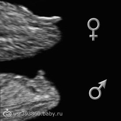 Мальчики девочка отличия при беременности