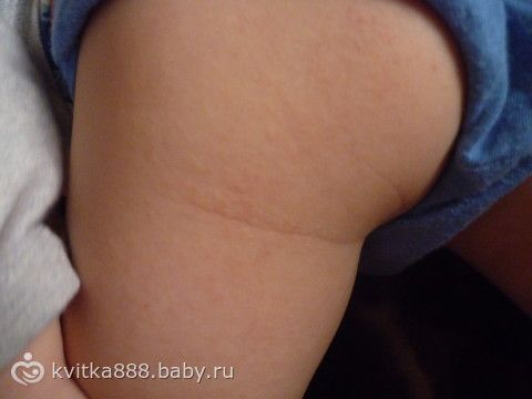 Настрой сытина для костей и суставов Настрой сытина для костей и суставов