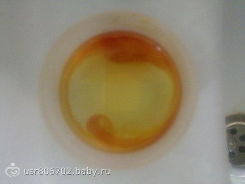 Как определить беременность в домашних условиях на раннем сроке