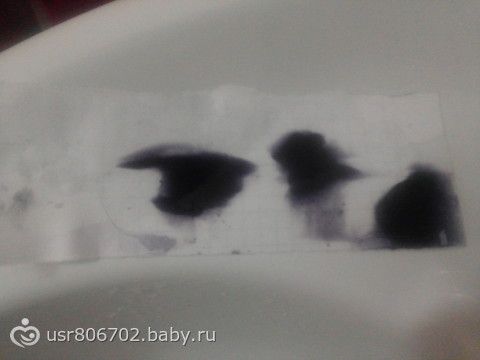 Реакция беременной мочи на йод 26