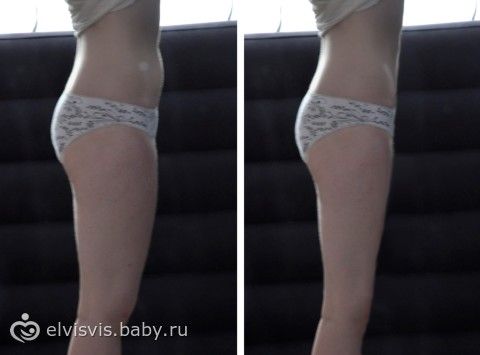 жир верхней части живота жир верхней части живота