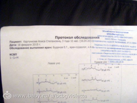 Сделали ксвп.