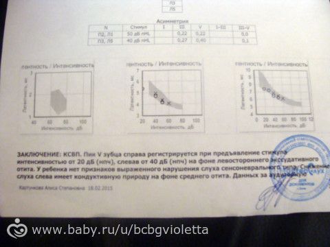Сделали ксвп.