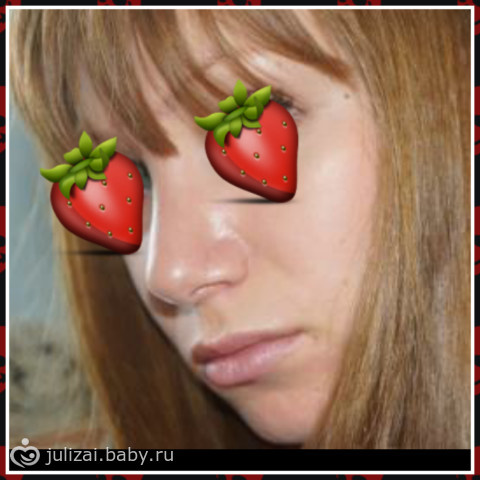 5 мес.после рино