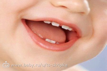 Опрос для мам, которые прошли или проходят этот страшный процесс &quot;зубки режутся&quot;.