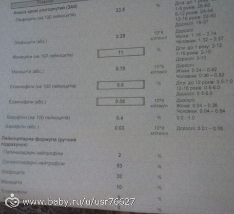 2,5 недели после отмены фраксипарина.Гемостаз и ОАК