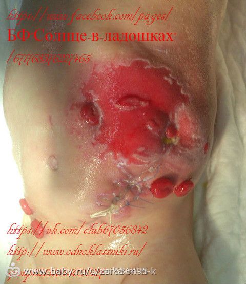ДЕВОЧКИ ОЧЕНЬ СРОЧНО!!!! Беременным и слабонервным не заходить.