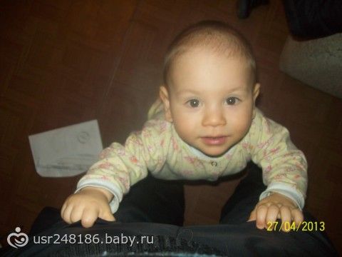Есть ли повод для беспокойства? асимметрия лица, черепа? Есть ли повод для беспокойства? асимметрия лица, черепа?