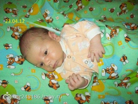 Есть ли повод для беспокойства? асимметрия лица, черепа? Есть ли повод для беспокойства? асимметрия лица, черепа?