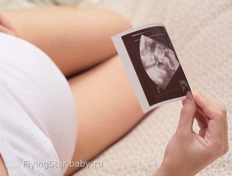 Цикл статей &quot;Контрольные этапы во время беременности&quot; Второй триместр