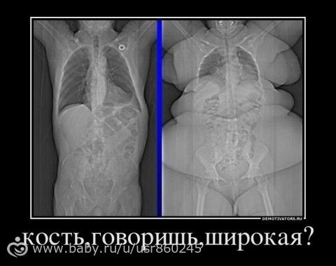 Статья 13. Ошибки в мотивации похудения.