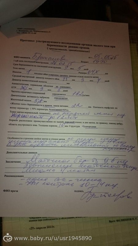 ппц! Сходила на узи!