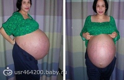 Беременная Китаянка С Большим Животом В Купальнике