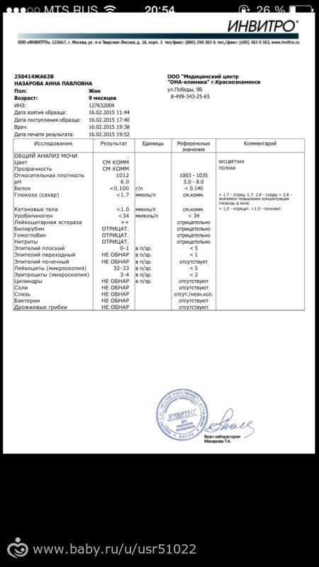 Анализ мочи
