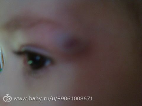 Как сделать выпирающие вены