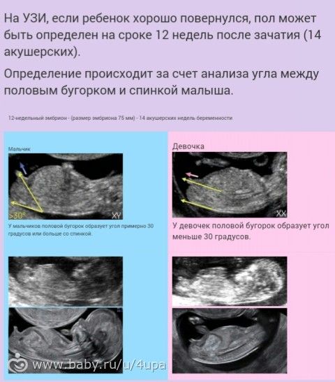 Когда можно узнать пол ребенка по узи. Пол по УЗИ. Девочка по УЗИ.