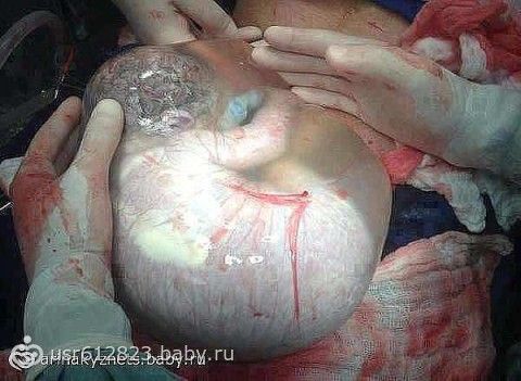 27 неделя беременности: описание, фото, видео, размеры 27 неделя беременности: описание, фото, видео, размеры